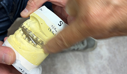 白楽の歯医者なら柿山歯科・矯正歯科医院｜Fプレート